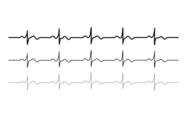 Conjunto Ritmo Cardíaco Normal Preto Vetorial Eletrocardiograma Ecg Sinal Ekg — Vetor de Stock