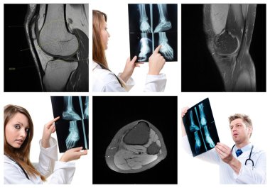 güzel genç doktorların tıbbi görüntüleme kolaj