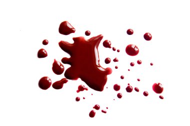 Kan lekeleri (damlacıkları)