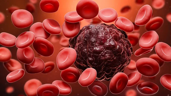 Cancer cell amidst red blood cells 3D rendering illustration. Oncology, cancerology, metastasis, medicine, microbiology, science, illness, health concepts.