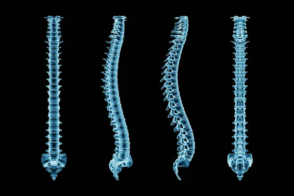 Ray Ανθρώπινη Σπονδυλική Στήλη Ραχοκοκαλιά Σπονδυλική Στήλη Από Διάφορες Γωνίες — Φωτογραφία Αρχείου
