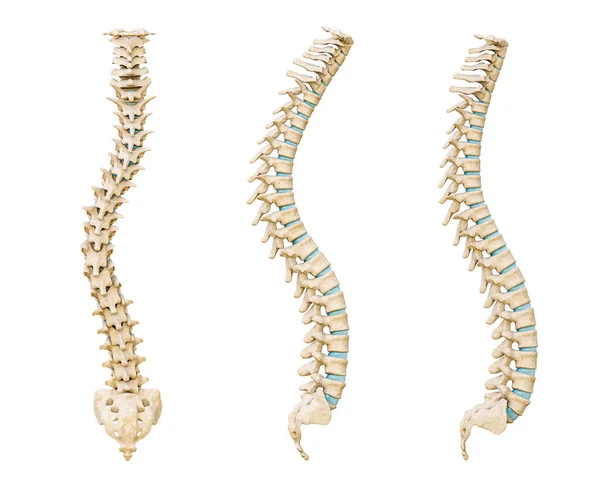 일반적 렌더링 삽화는 배경에 분리되어 Scoliosis Lordosis Kyphosis Curvature Spine — 스톡 사진