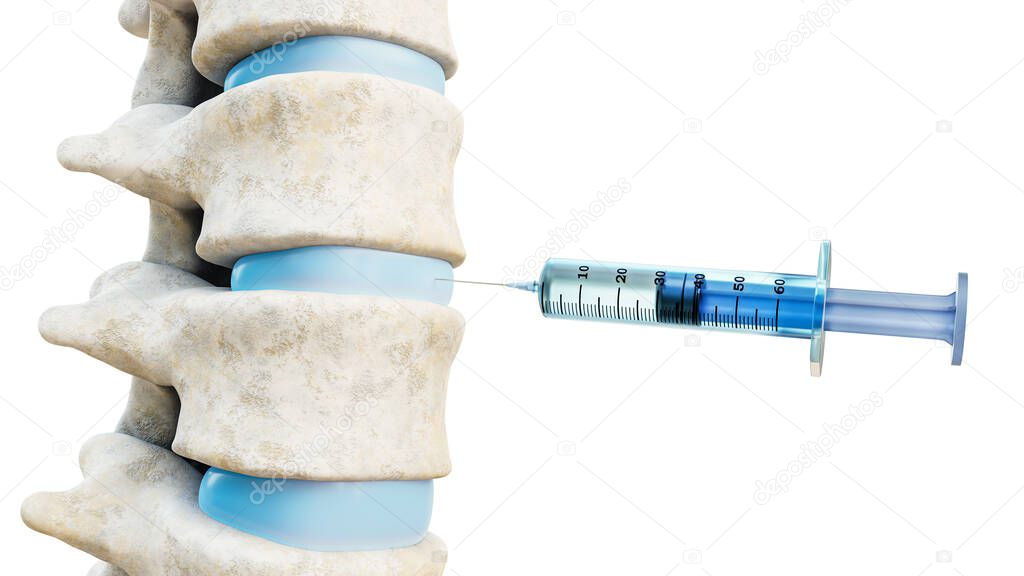 Close-up of intervertebral disk therapy injection. Syringe and human spinal column isolated on white background 3D rendering illustration. Medical and healthcare, medicine, anatomy concepts.