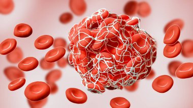 Close-up of a coagulated clot of red blood cells entangled in fibrin 3D rendering illustration. Thrombus, thrombosis, blood circulation, pathology, medical, science concepts. clipart