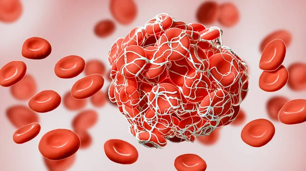 Close Coagulated Clot Red Blood Cells Entangled Fibrin Rendering Illustration — Stock Photo, Image