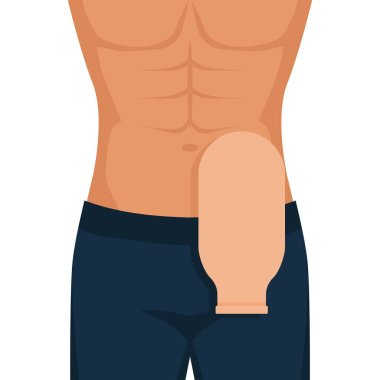 Man with Man with colostomy bag after colon cancer surgery clipart