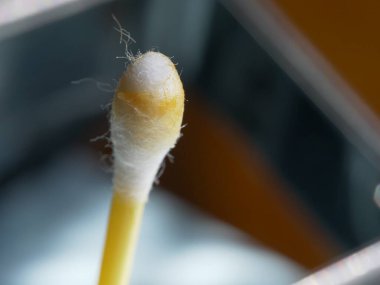 Pamuklu çubukta kulak kiri, makro fotoğraf. Kulak kiri ya da serumen (İngilizce: 