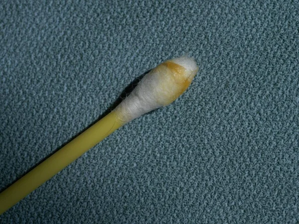 綿棒の上の耳垢マクロ写真 Earwax ヒトや他の哺乳類の耳管に分泌される褐色 オレンジ 灰色のワックス物質である — ストック写真