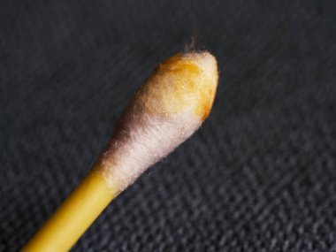 Pamuklu çubukta kulak kiri, makro fotoğraf. Kulak kiri ya da serumen (İngilizce: 