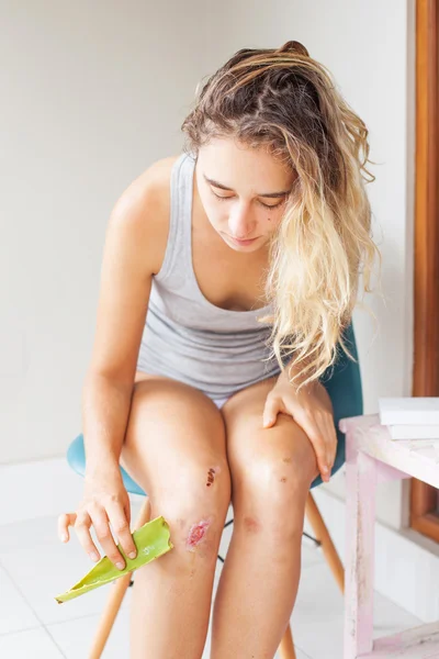 Mujer desinfectando su herida con aloe —  Fotos de Stock