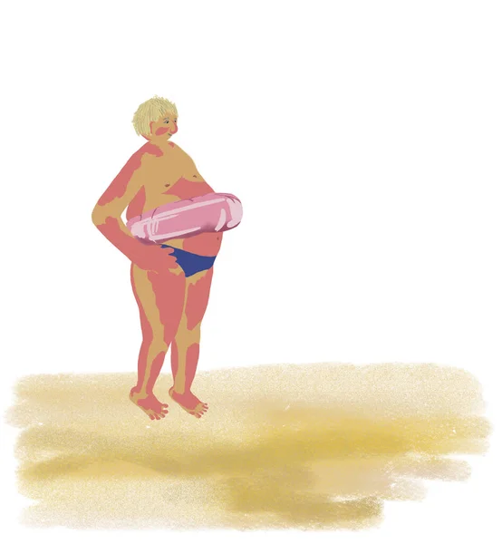 fat man with a red tan, on the beach