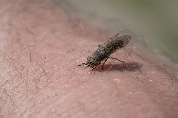 인간의 피부에 botfly 스탠드 — 스톡 사진