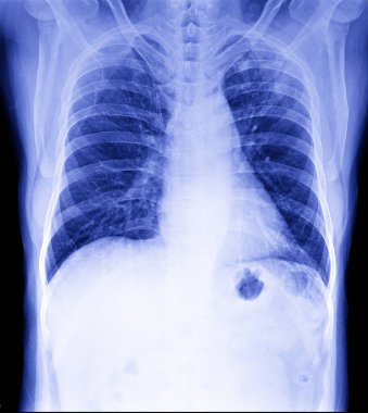 omurga x-ray görüntü.