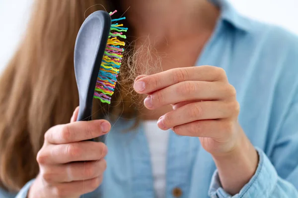 Woman Comb Suffering Hair Loss Treatment Hair Problems — Stock Photo, Image