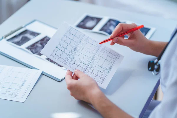 Médico General Examina Electrocardiograma Del Paciente Durante Chequeo Salud Una — Foto de Stock