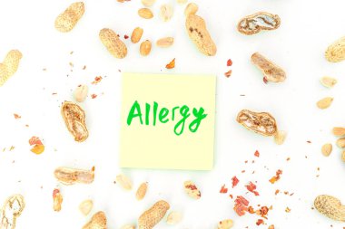 Peanut allergy concept. Food intolerances and food allergies