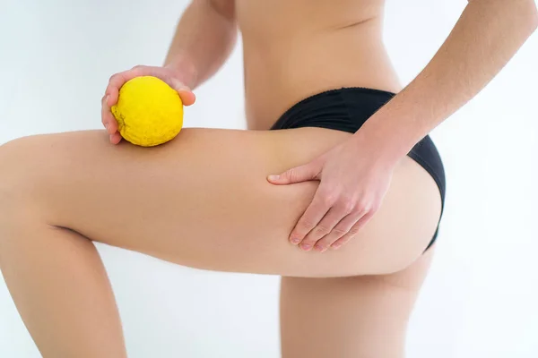 Female Legs Cellulite Treatment Prevention Problem Body Skin Healh Skin —  Fotos de Stock