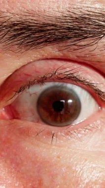 Adam hızlı göz değişimi fark eder, erkek tanıklar tarafından gözlemlenen hızlı göz bebekleri değişikliğine şaşırır, erkek tanıkların beklenmedik göz bebeği boyutları değişir, bu da bireysel şaşkınlığı gösterir.