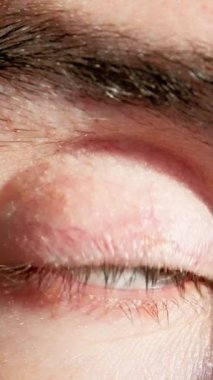 Klinik göz değerlendirmesi altındaki beyaz bir hasta, sabit bakışlı ve sterilize edilmiş çevreye sahip gözlerde tıbbi değerlendirme, göz kapağı hareketi ve göz yaşartıcı filme odaklanan göz doktoru denetimi