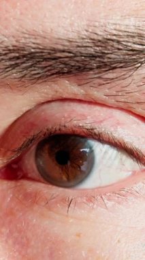 kırmızı tahriş olmuş göz beyaz adam alerji semptomu gösteriyor, yakın makro kan lekesi ve şişmiş göz kapağı, ince gözyaşı filmiyle klinik muayene titreşimi, cilt gözenekleri ve kaş detayı, nakil. 4k