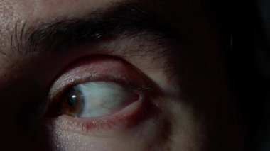 Makro sekansta kahverengi gözlü beyaz erkek göze hoş görünmeyen hareketler, yavaş göz kırpmalar ve kayan bakışlar gösteriyor. Klinik aydınlatma cilt dokusunu, kirpik detaylarını, hafif kızarıklığı ön plana çıkarıyor. 4k