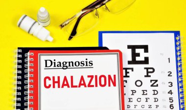 Chalazion. Görme sağlığını belirten metin etiketi. Teşhisi bir göz doktoru koymuştu. İlaç tedavisi.
