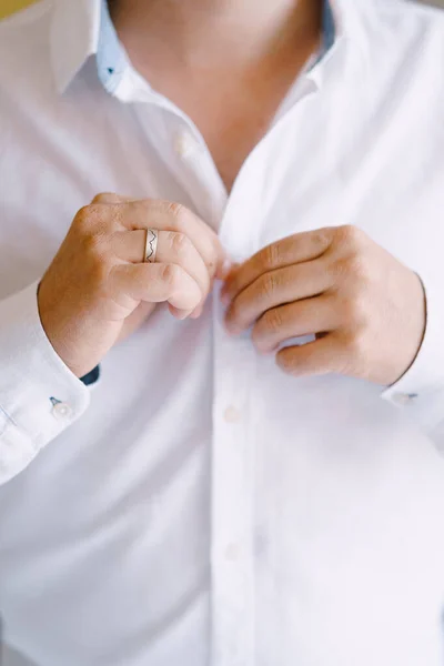 Lo sposo abbottona i bottoni della camicia bianca. Primo piano — Foto Stock