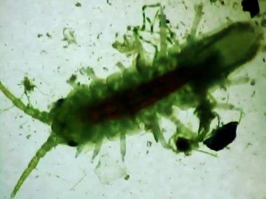 Mikroskop camında deniz karidesi