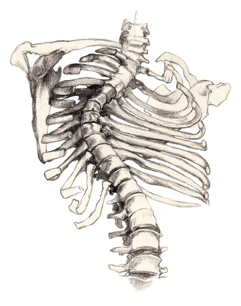Escoliosis de la columna vertebral — Foto de Stock