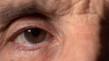 Yaşlı bir adamın gözleri. Göz küresindeki kılcal damarlar.