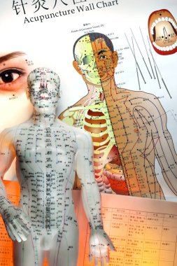Acupuncture is a system of complementary medicine that involves pricking the skin or tissues with needles, used to alleviate pain and to treat various physical, mental, and emotional conditions. 