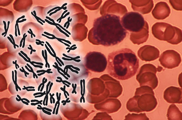 Ανθρώπινα Χρωμοσώματα Ένα Υπόβαθρο Των Κυττάρων Του Αίματος Είναι Κλωστή — Φωτογραφία Αρχείου