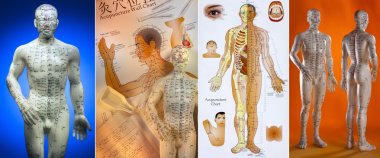 Akupunktur - Çin tıbbı
