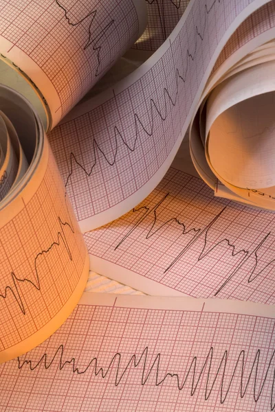 Electrocardiograph Traces Cardiac Arrhythmia (dalam bahasa Inggris). — Stok Foto