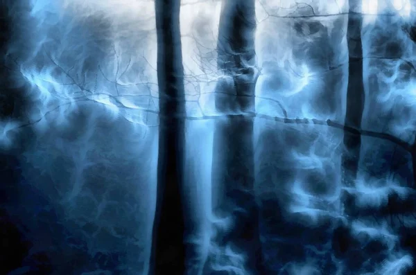 抽象绘画 超现实的黑暗森林 — 图库照片