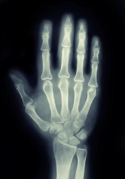 X-Ray hand — Stockfoto