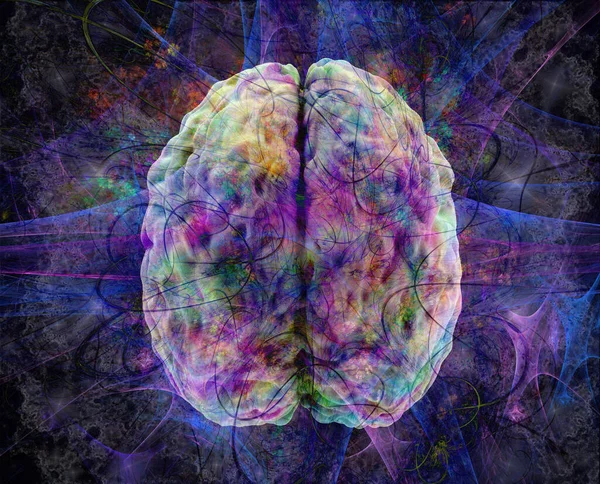 Model Otak Berlebih Manusia Berwarna Pikiran Berlebihan Konsep Aktivitas Otak — Stok Foto