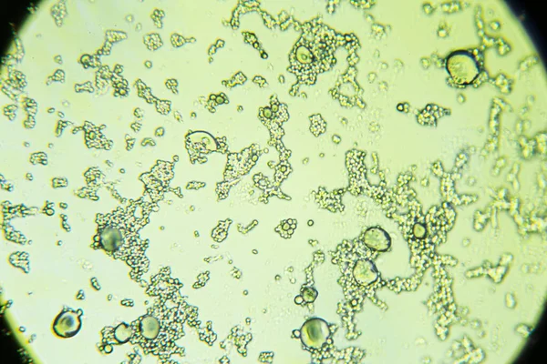 Spores Moisissure Sous Microscope Lumineux Moisissure Écorce Orange Grossissement 400 — Photo