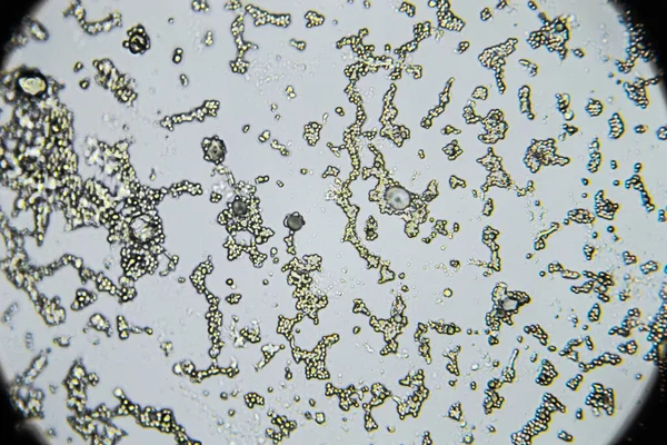 Mold spores under the light microscope, orange peel mold, magnification 400 times