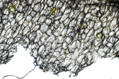 Işık mikroskobunun altında 100 kat büyütülmüş bir zencefil kökü.