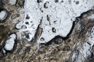 Hafif mikroskop altında süt sosisi dokusu, 100 kat büyütme