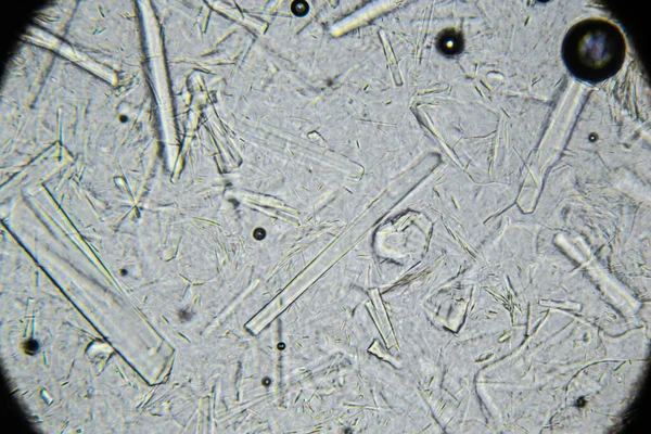 Mel Artificial Com Grandes Cristais Açúcar Retangulares Microscópio Mel Natural — Fotografia de Stock