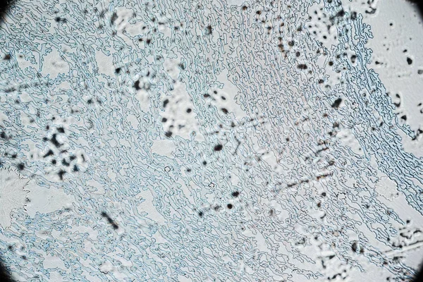 Eyaculación Humana Seca Textura Con Cristales Sal Bajo Microscopio Luz Fotos de stock