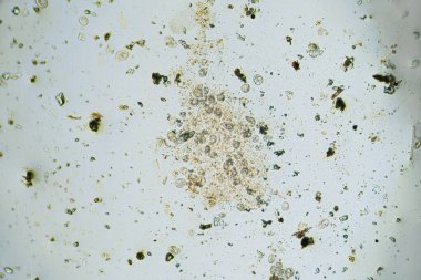 Işık mikroskobu altında bir sürü ciliate var.