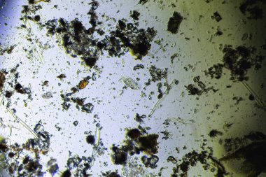 Işık mikroskobu altında stilonichia mytilus ve mikro algler