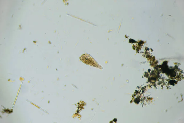 Ciliates Stentor Ditemukan Kolam Air Tawar Bawah Mikroskop Cahaya — Stok Foto