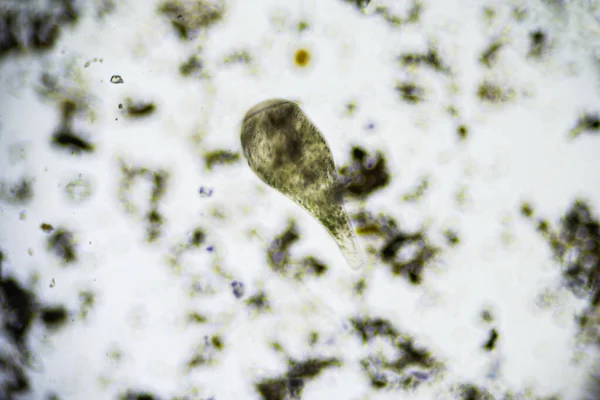 Ciliates Stentor Znaleziony Stawie Słodkowodnym Pod Mikroskopem Świetlnym — Zdjęcie stockowe