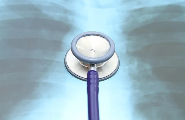 Close up image of stethoscope on top of x-ray film — Stock Photo, Image