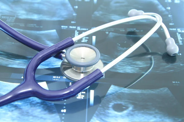 Nahaufnahme eines Stethoskops auf Röntgenfilm — Stockfoto