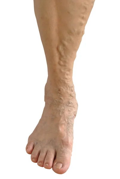 Нога старухи — стоковое фото